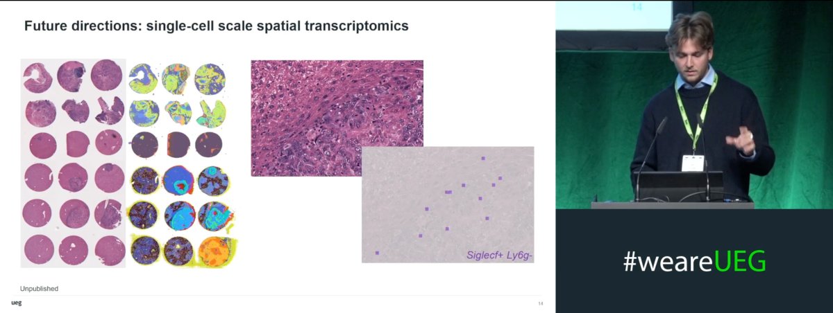 Dr. De Lange presenting at UEG Week 2025
